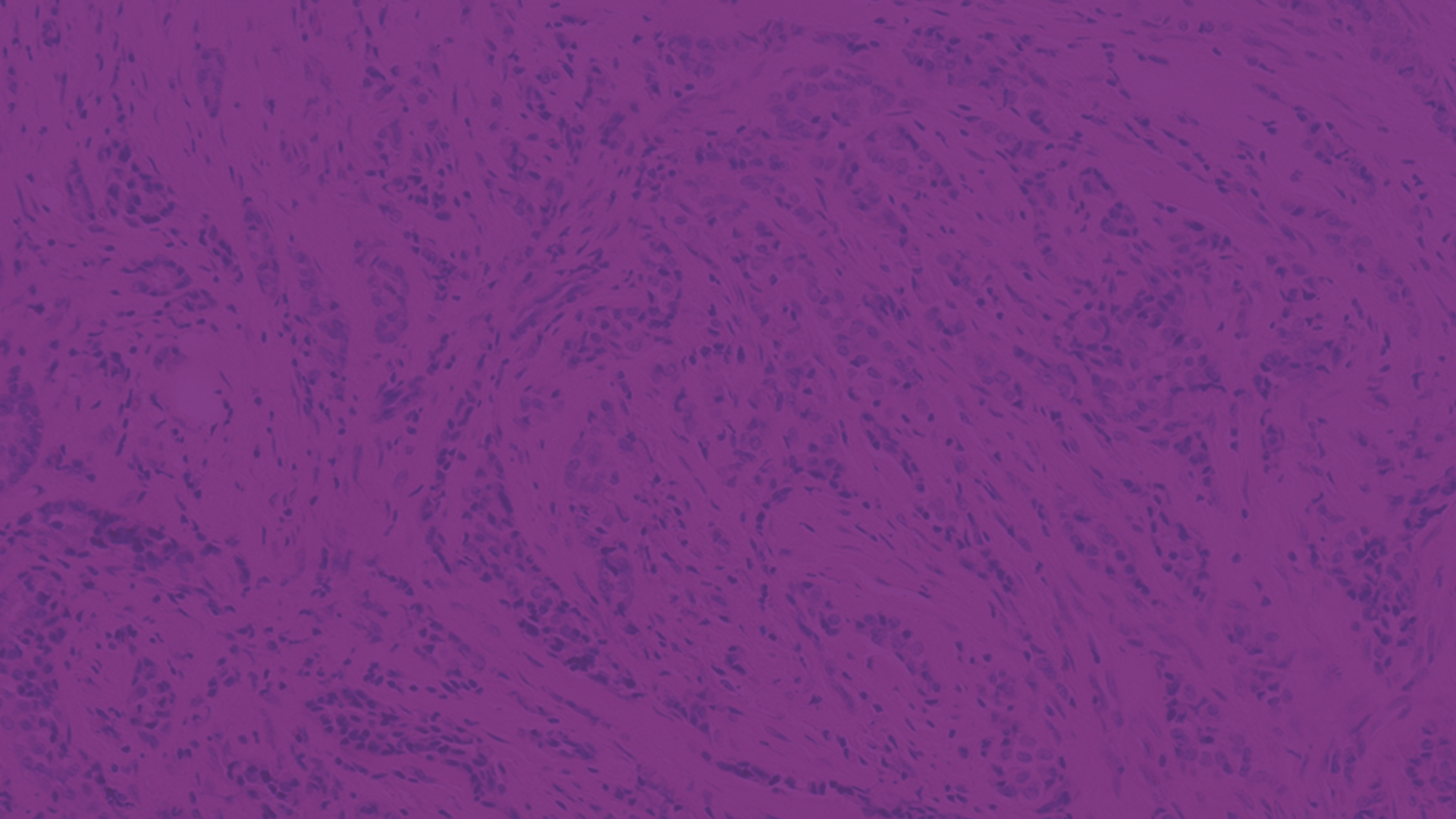 Specifie an alternate text for an image