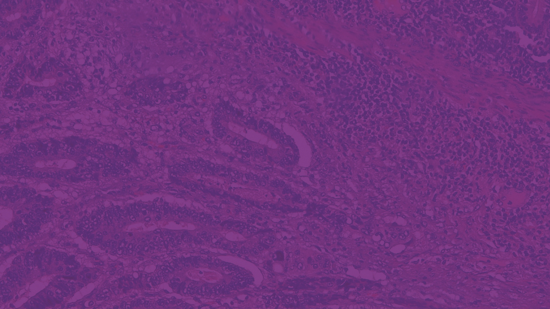 Specifie an alternate text for an image