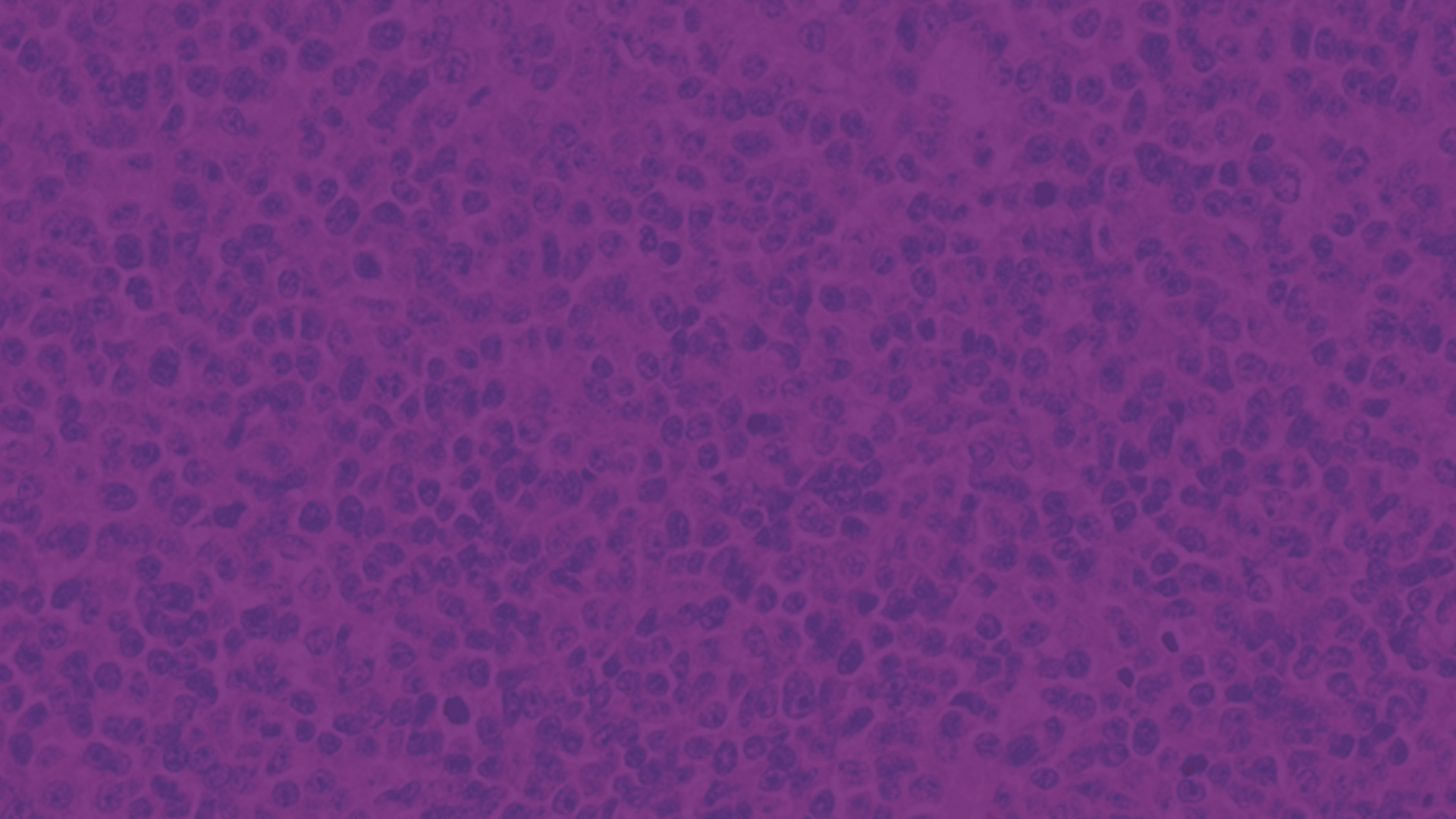 Specifie an alternate text for an image