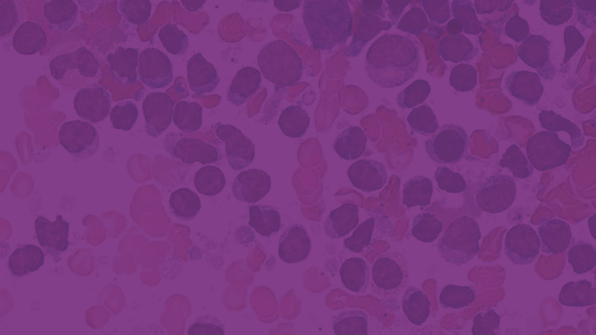 Specifie an alternate text for an image