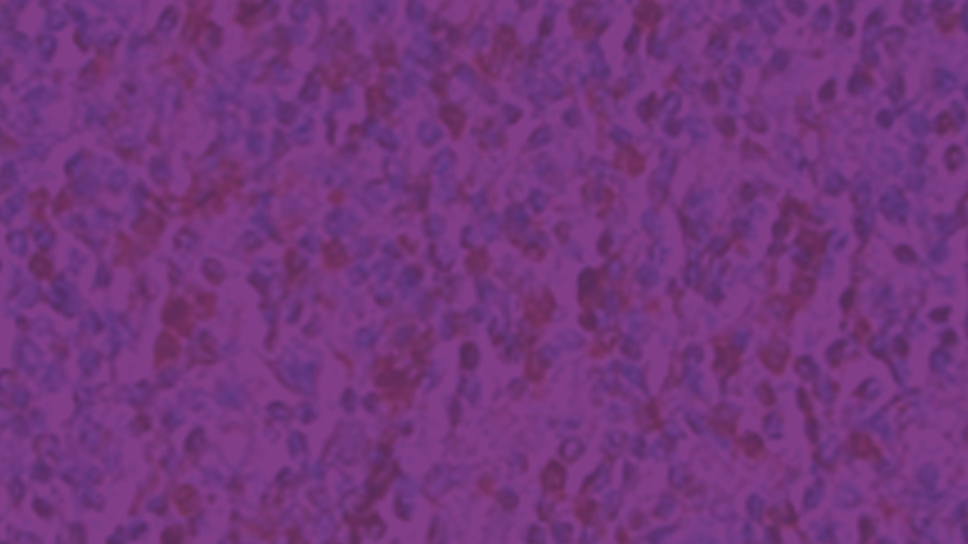 Specifie an alternate text for an image