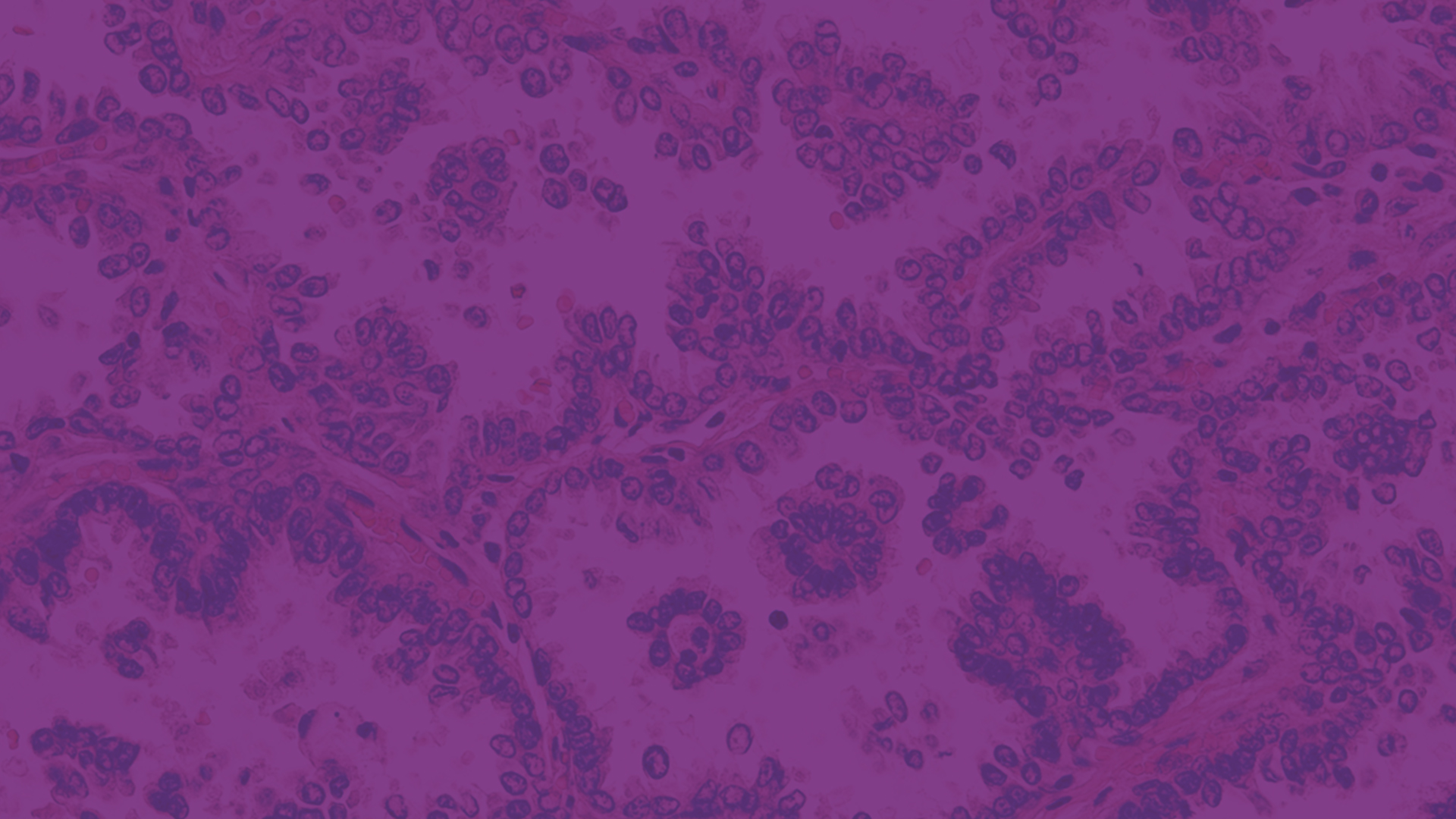 Specifie an alternate text for an image