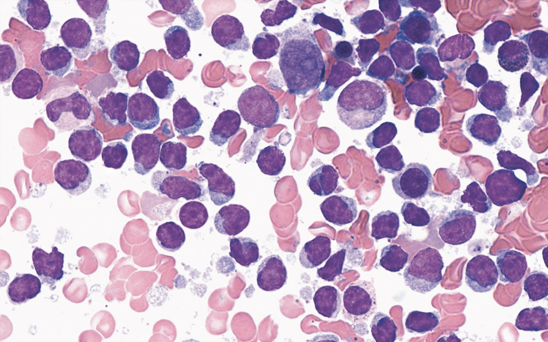 Specifie an alternate text for an image