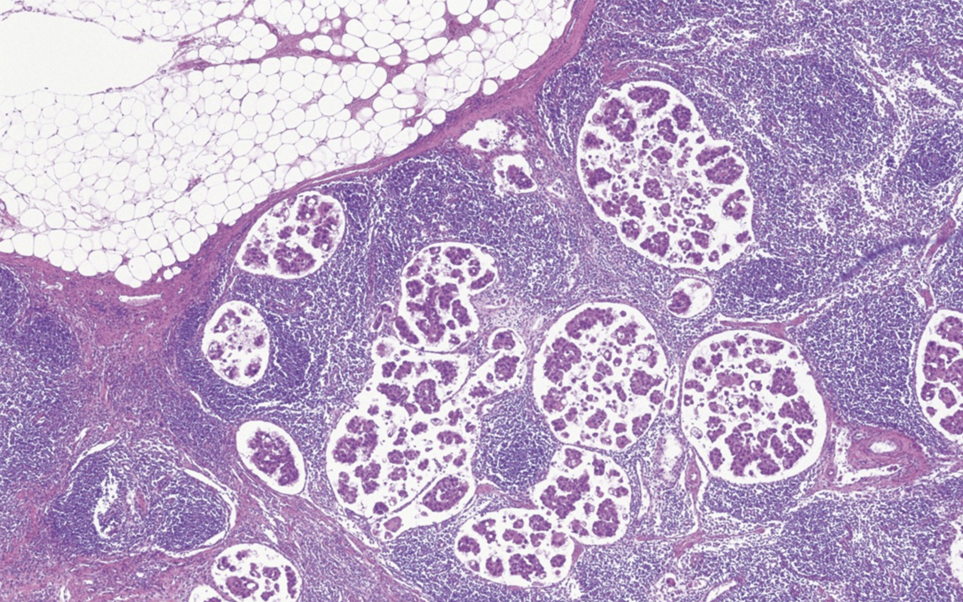 Specifie an alternate text for an image